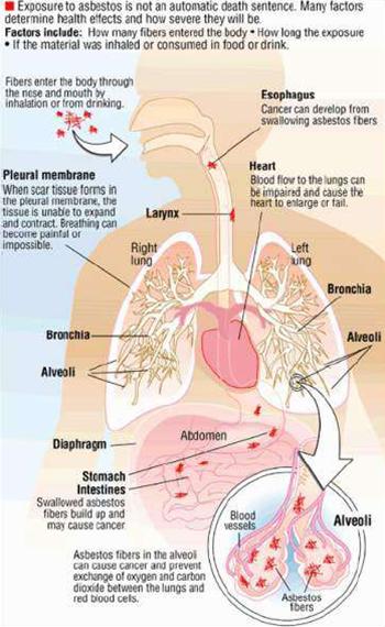 Šíření azbestových vláken po lidském těle při jejich inhalaci